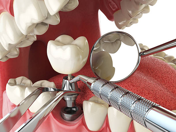 Best Emergency Dental Surgery in Kingfisher, OK
